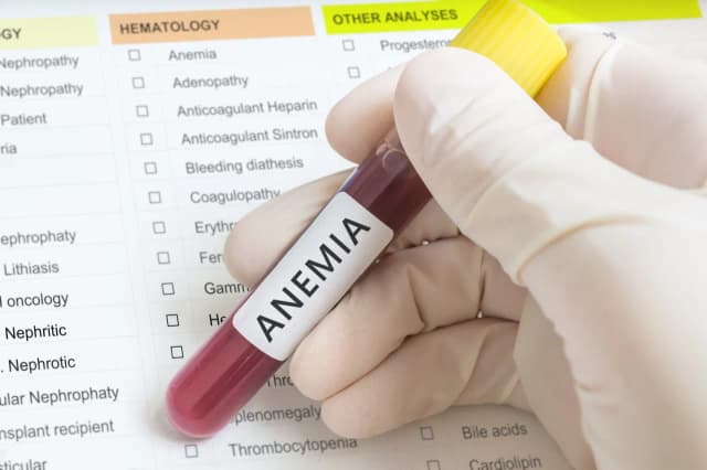 Anemia w ciąży - jakie wyniki badań alarmują i co oznaczają?