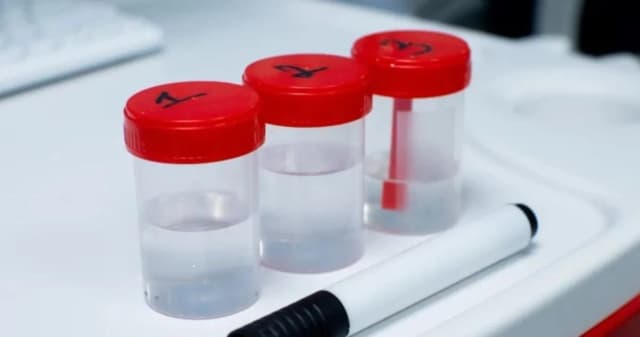 Jakie badania z kału pomogą w diagnostyce problemów zdrowotnych Jakie badania z kału pomogą w diagnostyce problemów zdrowotnych